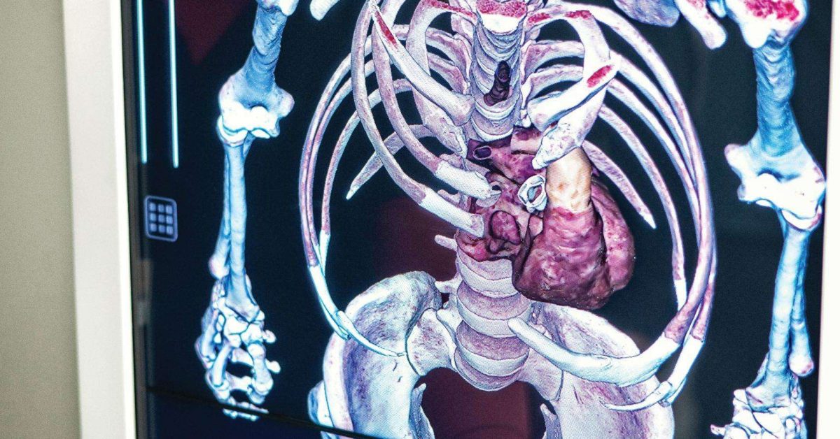 Anatomage Table_NCH_Simulation_Center-20